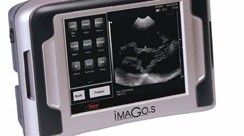 « Confirmer une gestation, détecter les jumeaux, sexer le fœtus… moi-même ! » « Confirmer une gestation, détecter les jumeaux, sexer le fœtus… moi-même ! »