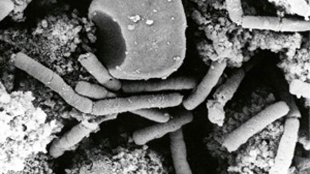 Dix-neuf bovins meurent de la fièvre charbonneuse en Moselle