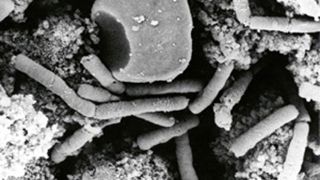 Dix-neuf bovins meurent de la fièvre charbonneuse en Moselle Dix-neuf bovins meurent de la fièvre charbonneuse en Moselle