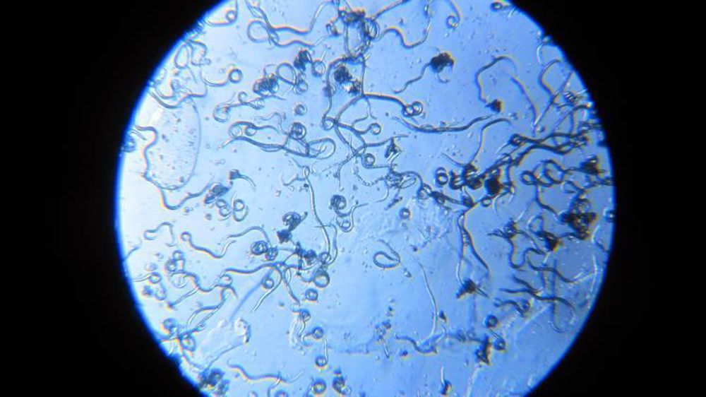 Une partie des nématodes sont des ravageurs parasitoïdes. © BASF